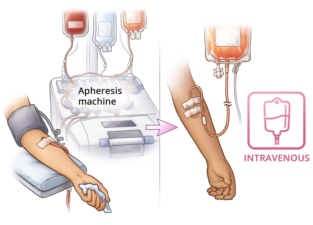 Apheresis machine INTRAVENOUS